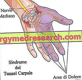 Dureri la articulațiile degetelor - ce ar putea fi? (diagnostic diferențial)