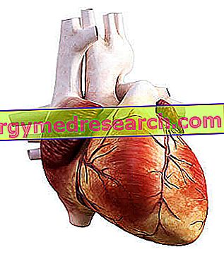 Infarct miocardic - Boala ischemică cardiacă - Programează-te la medic!