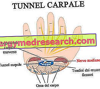 Túnel carpiano