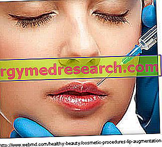 Ustnice: absorpcijska polnila na osnovi hialuronske kisline