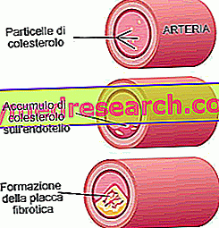 Атеросклерозата