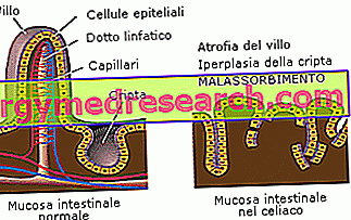 malabsorpcie