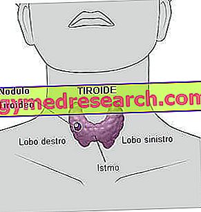 Tumor tiroideo