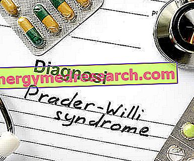 Zdravila za zdravljenje Prader-Willijevega sindroma