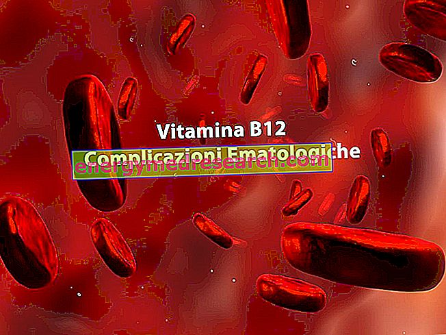 Integracija su B12 ir hematologinėmis komplikacijomis