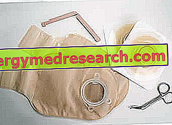 ileostomia táska fogyni