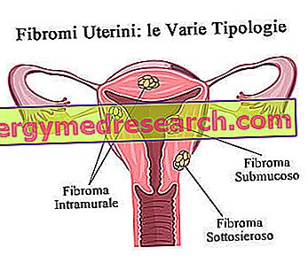 Metode pentru îndepărtarea unui polip în uter, cursul operației, tratament postoperator