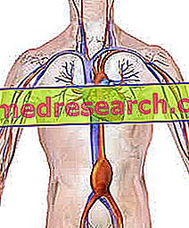 Anévrisme de l'aorte abdominale