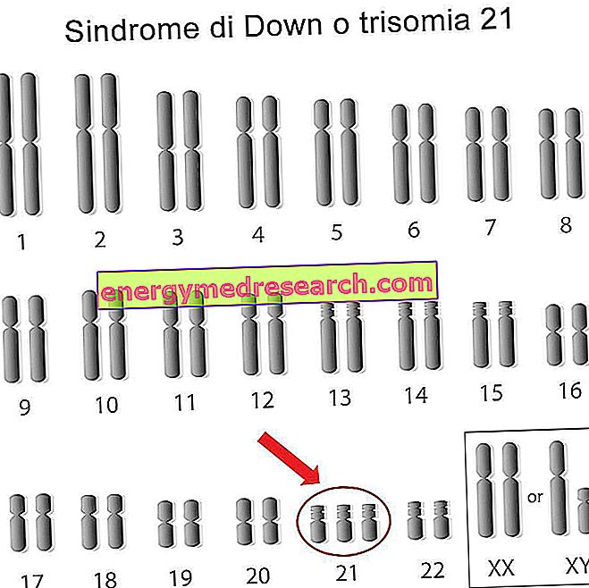 Variationer i antallet af kromosomer hos mennesker: aneuploidi