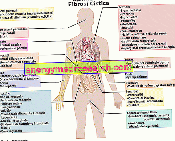 Кістозний фіброз - діагностика та терапія