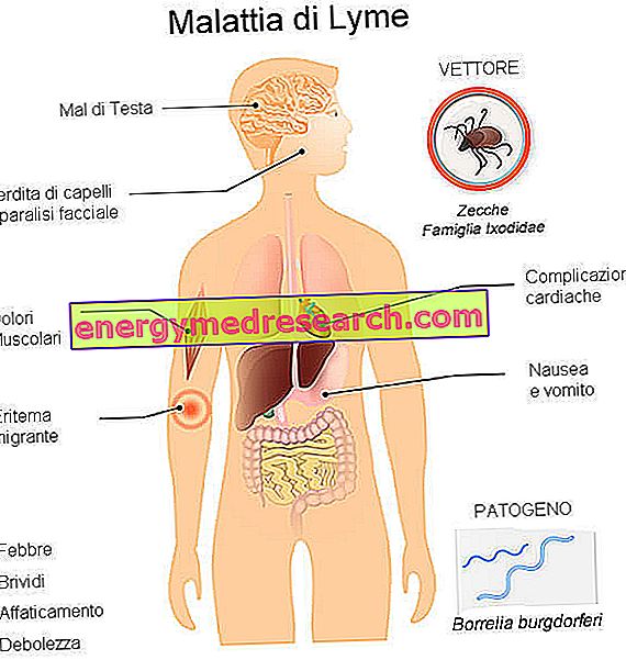 Boala Lyme: simptome, cauze, tratament