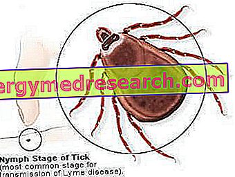 Simptomele bolii Lyme, erupții cutanate, tratamente - Sănătate - 