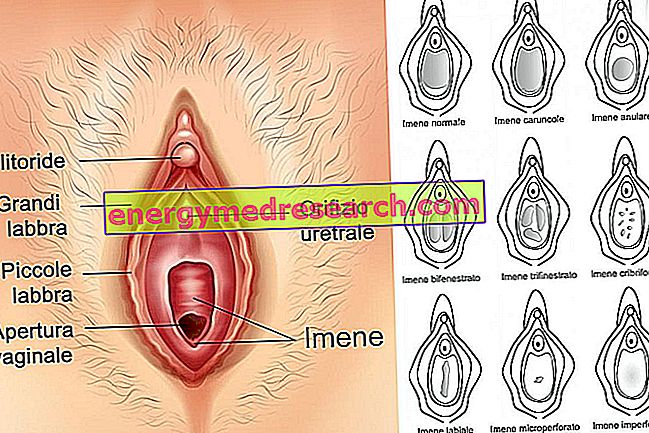 Hymen impérissable et menstruation