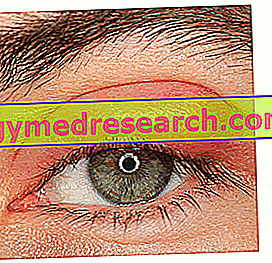 hipertenzijos akių simptomai