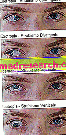 Glaukoma ir katarakta – klastingos akių ligos