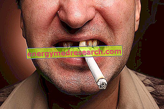 煙と歯：喫煙は歯に悪いので