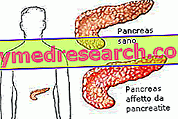 панкреатит