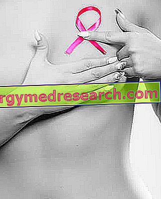 poate pierderea în greutate cauza mamografiei anormale)