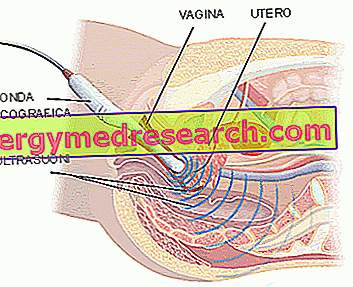 Ultrasound transvaginal
