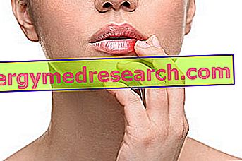 Chéilite (inflammation des lèvres): de quoi s'agit-il?  Causes, symptômes et soin de G. Bertelli
