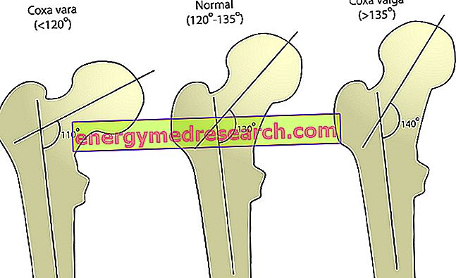 Totul despre artrita genunchiului - Simptome, tipuri, tratament | csdownload.ro