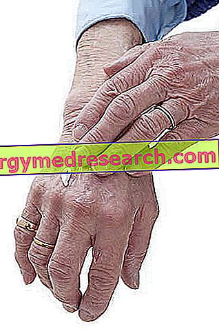 ce boli sunt însoțite de durere în articulații artróza pánve