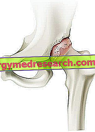gel pentru spate și articulații unguente de încălzire pentru artroza articulației genunchiului
