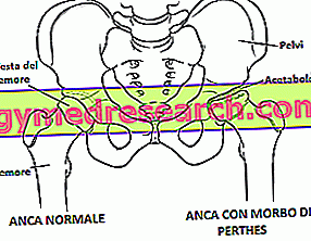 șolduri ale articulației șoldului cum să alinați durerea în articulațiile coatelor