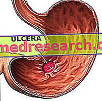 ulcerul duodenal provoacă pierderea în greutate)