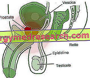 Infekcia prostaty