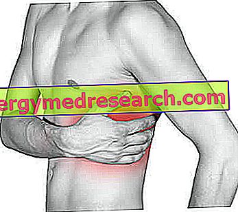 Intercostal pain - Intercostal pains