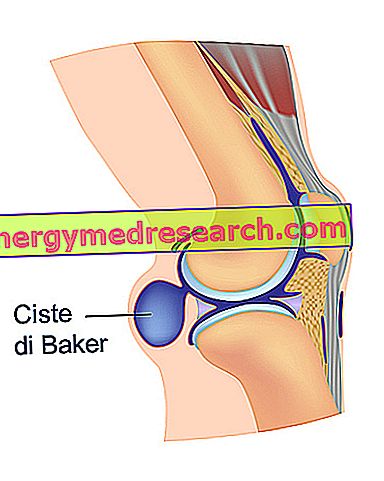 Ce ar putea cauza durerea bruscă a genunchiului?