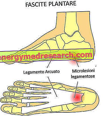 pėdos pakyla su hipertenzija tachikardijos gydymas esant hipertenzijai