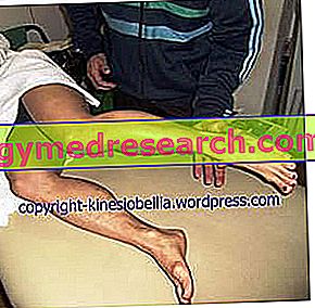 Lesão do ligamento cruzado anterior LCA) e tratamento com fita cinesiológica ®.