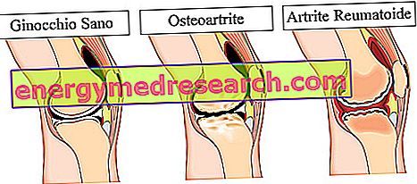 articulația genunchiului ce boli)