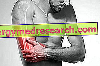 Inflamația ligamentelor și tendoanelor articulației șoldului Inflamația articulației șoldului