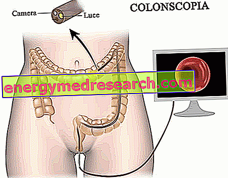 Cáncer de colon - Diagnóstico